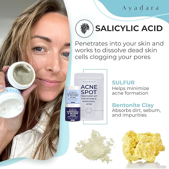 Day & Night Cystic Acne Spot Treatment, Hormonal Acne Treatment For Daytime & Overnight, Severe Acne, Cystic Acne Treatment for Face, Pimple Cream Tea Tree Bentonite Clay, 90 Day Supply