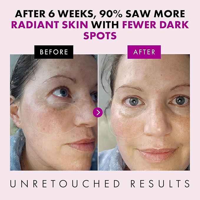 Eclat Skincare Anti Aging Face Cream - Hydrating Face Moisturizer with Collagen Peptides, Hyaluronic Acid, & Vitamins C+E - Improves Fine Lines and Wrinkles - Daily Facial Moisturizer 50 ml