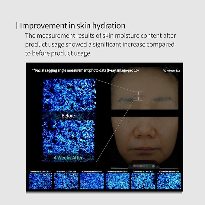 Edelweiss Lifting Serum – Anti-Aging Formula with Edelweiss Extract, Niacinamide, Peptides for Firming, Hydration & Brightening – 1.35 fl.oz