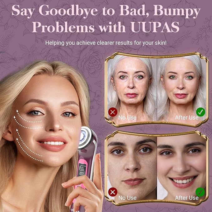 UUPAS Smart Photon Micro-Current LED Red Blue Light Therapy Wand for Face - Microcurrent Facial Device