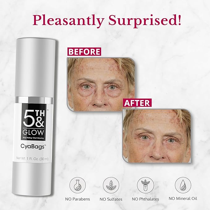 5th & Glow Cyabags - Eye Serum - Instant Eye Bag Remover and Eye Puffiness Reducer with Hyaluronic Acid and Vitamin C for Fine Lines, Wrinkles, and Under Eye Bags, 1 oz