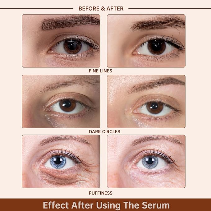 Caffeine Solution 5% + EGCG Eye Serum for Skin Care Caffeine Eye Hyaluronic Acid Reducing Puffiness and Dark Circles, Niacinamide Under Serum, Under Bags and Wrinkles 30ml