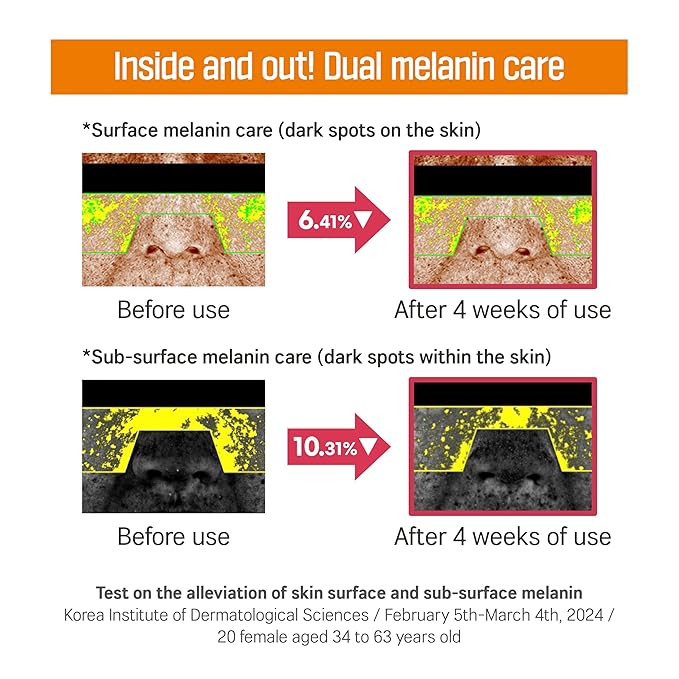 ROUND LAB Vita Niacinamide Dark Spot Serum 1.01 Fl Oz, Radiance-Boosting and Dark Spot Correcting Face Serum with Vitamin C, Improves Uneven Skin Tone, and Enhances Skin Clarity, Korean Skincare