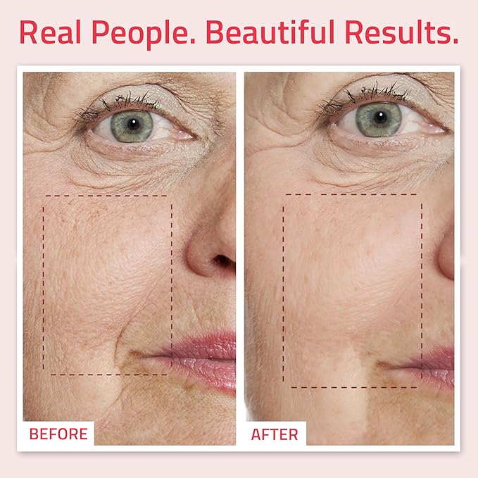 YEOUTH Retinol Serum for Face with Hyaluronic Acid & Vitamin E, Hydrating Retinol for Face, Night Serum Suitable for All Skin Types 1oz