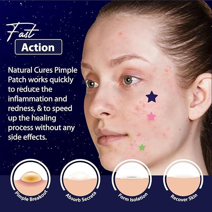 Star Pimple Patches for Face – Hydrocolloid Acne Patches for Quick Zit Relief and Blemishes, Invisible Spot Stickers That Stay All Night, Gentle for All Skin Types, Oil-Free (240 Count)