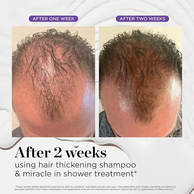 Dr. Groot Miracle in Shower Treatment for Hair Loss, Korean Hair Care, 5 Seconds to Smooth Hair, Rosemary Oil for Healthier-Looking Hair, Hair Rinse, Moisturizing Treatment,Scalp Revitalizing Solution