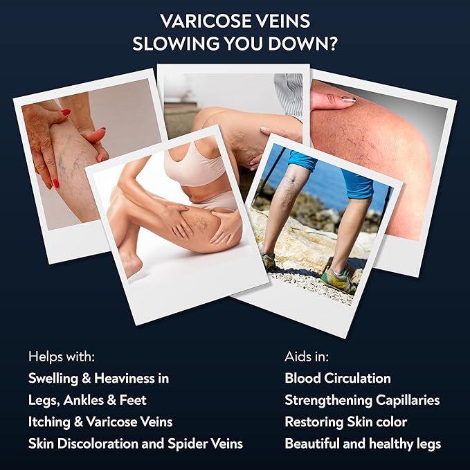 Advanced Vein Care Kit of America's 1st Ashwagandha Cream & Reduce Varicose Veins & Boost Circulation with 60 Easy-to-Swallow Ayurvedic Tablets of Ashwagandha, Punarnava, Turmeric & Triphala