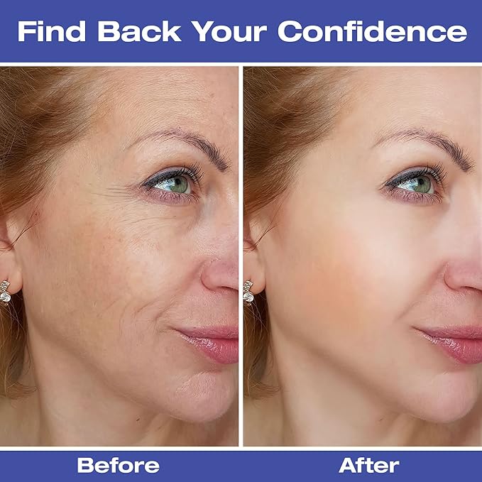 2-pack Forehead Wrinkle Patches, Wrinkle Patches for Face Overnight, 160 PCs Face Tape for Wrinkles, Facial Wrinkle Remover Strips, Anti Wrinkle Patches to Smooth Eye, Mouth, Forehead