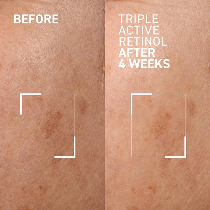 Dr. Brandt Bright This Way Triple Active Retinol - Gentle Overnight Renewal Cream - Reduces Wrinkles & Discoloration, Illuminates & Hydrates - 1 oz