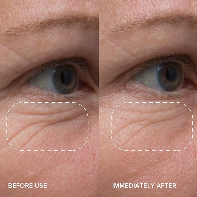 Alpyn Line-Filling Eye Balm with Bakuchiol & Caffeine, Reduce the Look of Fine Lines & Wrinkles, Minimize the Appearance of Puffiness & Target Dark Circles, 0.5 oz / 14 ml