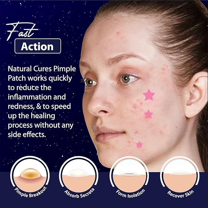 Star Pimple Patches for Face – Hydrocolloid Acne Patches for Quick Zit Relief And Blemishes, Invisible Spot Stickers That Stay All Night, Gentle for All Skin Types, Oil-Free (80 Count)