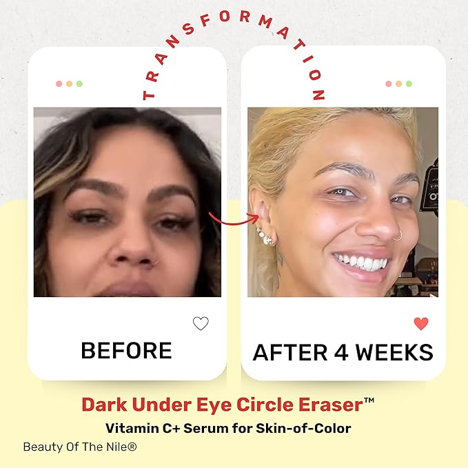 Dark under eye circle eraser??vitamin