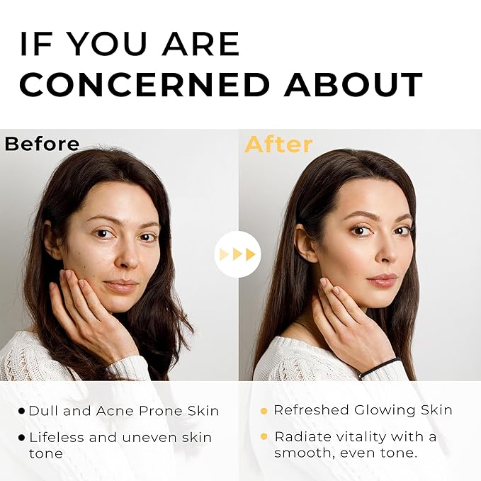 Italian White Truffle Spray Serum - Vegan Skin Care - Face Mist Hydrating Spray with Avocado & White Truffles - Face Serum for Radiant Skin - 3.38 Fl Oz