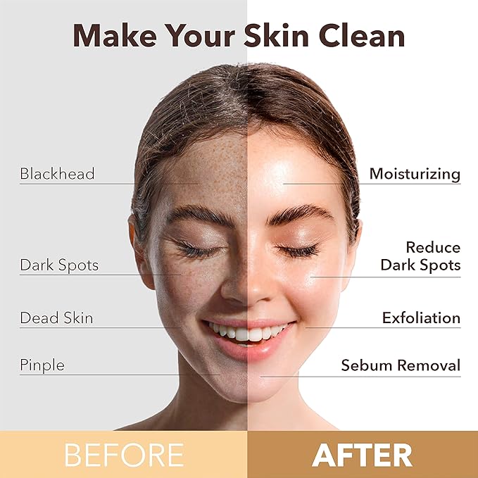 PUREDERM Deep Purifying Green O2 Bubble Mask 0.88oz x 5ea / Korean beauty/Bubble mask/Cleansing foam/Cleanser/Purifying mask/Green tea mask/Face toxin