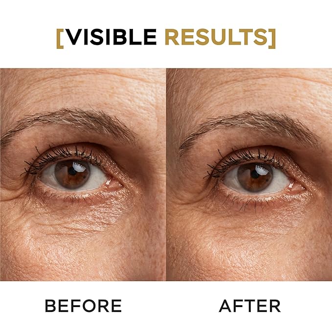 Moisturizing Eye Cream w/Aloe Vera, Collagen, Hyaluronic Acid, Cotton Stem Cells for Dark Circles, Puffiness & Bags - Under Eye Hydration Cream for Women & Men (1 Fl Oz)