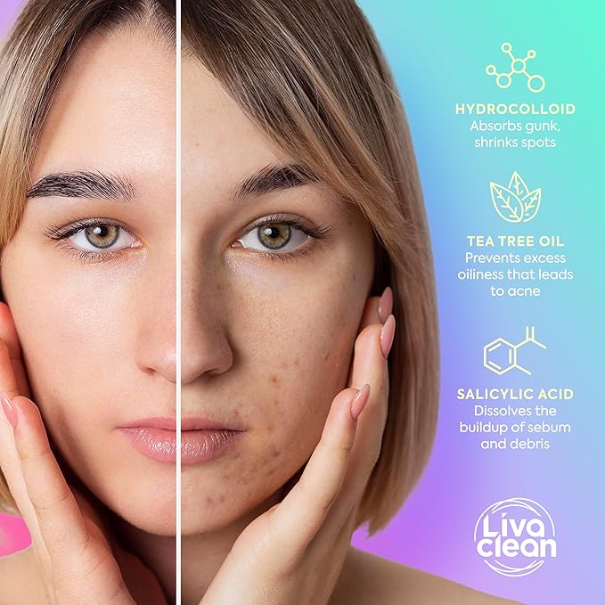 LivaClean 240 CT Cute Pimple Patches for Face w/Salicylic Acid & Tea Tree, Hydrocolloid Acne Patches Cute Star Pimple Patch for Healing, Adorable Face Stickers, Zit Patch