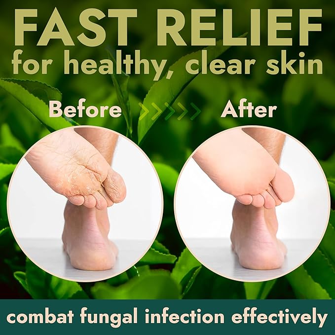 Terramed Just Think Comfort Antifungal Foot Treatment with Tea Tree Oil | Treatment for Jock Itch, Athlete’s Foot, Nail Fungus & Ringworm (Scrub)