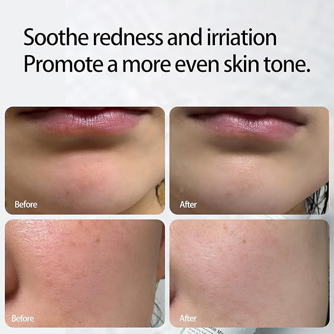 Aloe Vera and Centella Asiatica Toner Mist Spray - Korean Hydrating Skincare Toner - Face Mist for redness and dryness