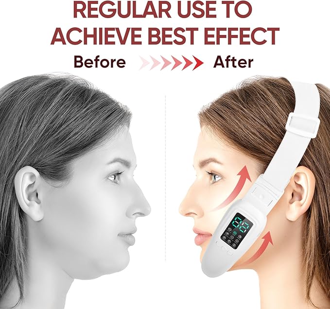 Intelligent Electric Double Chin and V-Shaped Face Machine with 8 Modes & 15 Adjustable Intensities - Women's V-Face Device
