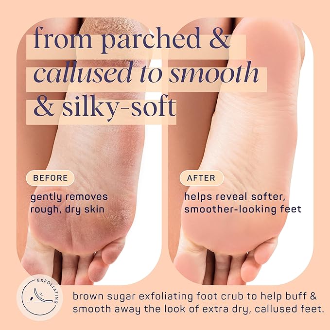 SpaLife Beauty Brown Sugar Foot Scrub – Exfoliating Foot Treatment for Dryness & Roughness – Sugar Scrub for Feet – Made with Shea Butter & Sweet Almond Oil to Soften & Smooth Skin