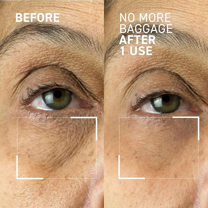Dr. Brandt Needles No More, No More Baggage - Minimizes Under-Eye Bags, Puffiness & Dark Circles - 0.5 oz