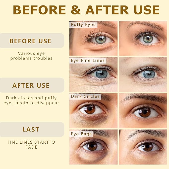 COSMETIC |24K Gold Pure Luxury Lift & Firm Hydra-Gel Eye Patches | Anti-Aging Under-Eye Patches, Help Lift and Firm the Look of the Eye Area
