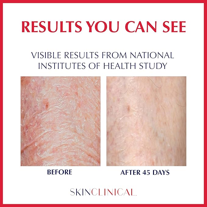 Relieve + Repair Body Moisturizing Lotion for Extremely Dry Skin, Hand and Face Lotion with Patented Ingredient SBD-4 for Acne Prone, Shin Spots, Blisters and Itchy Skin, Unscented 3oz