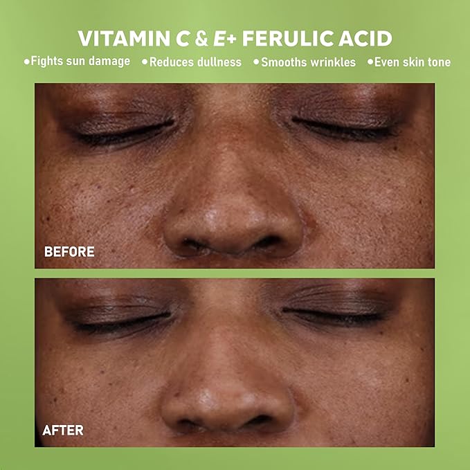 DERMAdoctor 20% Vitamin C Face Serum with Vitamin E & Ferulic Acid | Kakadu C Dermatologist-Formulated Anti-Aging, Hydrating & Discoloration Correcting Serum | Dark Spot Corrector - 1.0 fl oz