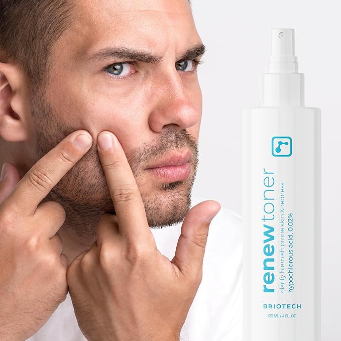 BRIOTECH Skin Renew Toner, Hypochlorous Acid Spray Topical Skin Spray for Face and Skin, Minimize Appearance of Blemishes, Soothing Mist for Redness & Bumps, 4 fl oz ea, 4 ct