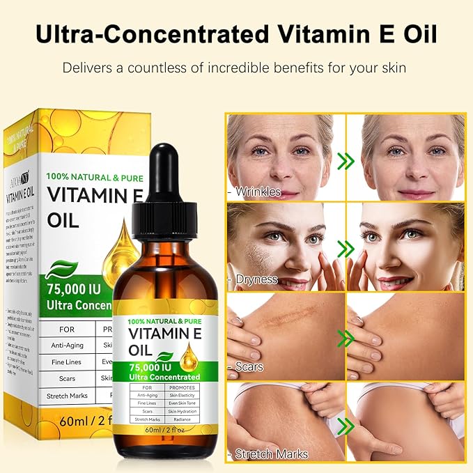 Vitamin E Oil, 75000 IU Ultra Concentrated, 100% Natural Body Oil Moisturizing Dry Skin, Pure Vitamin E Oil for Skin, Scars, Face, Hair, Nails, Hexane-Free, Non-GMO, 2 Fl Oz
