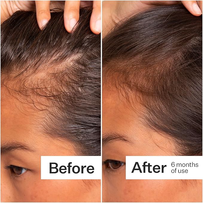 Act+Acre Cold Processed Stem Cell Scalp Serum - Promotes Thicker and Fuller-Looking Hair - Soothes and Hydrates the Scalp - Sulphate and Paraben Free - Aloe Vera for Improved Scalp Health.