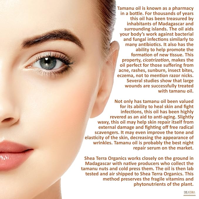 Shea Terra Madagascar Tamanu Cold-pressed Extra Virgin Oil |All Natural & Organic Oil Rich in Anti-Aging Amino Acids & Anti-Acne Properties for Softer, Hydrated & Blemish-Free Skin – 2 oz