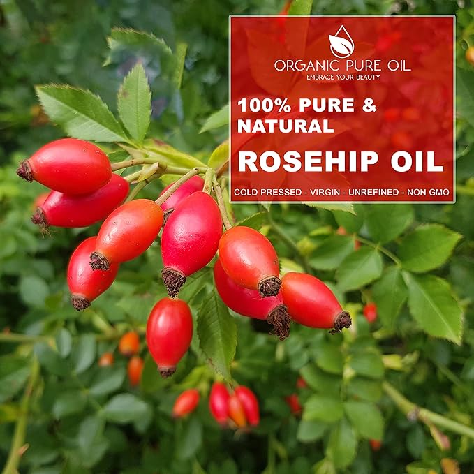 OPO Rosehip Oil - 8 oz - Pure, Unrefined, Non GMO, Cold Pressed, Vegan Carrier Oil for Face, Hair, Skin, Nails, Body Aging Skin Beard Locs Mustache Lashes - Packaging May Vary