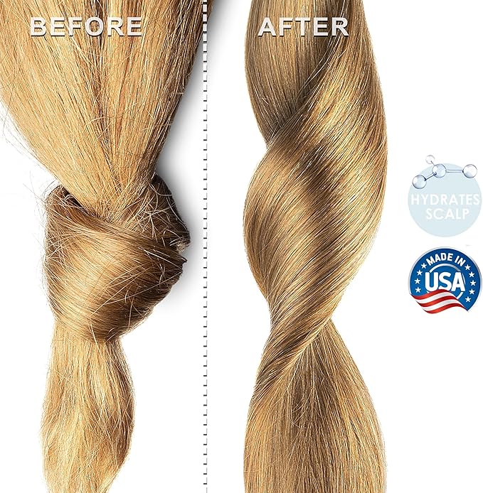 Soapeauty Clear Jojoba Oil | 100% Pure & Natural | Refined, Cold Pressed, Hexane Free | Moisturizing Oil for Skin, Face, Hair & Nails | 32 fl oz