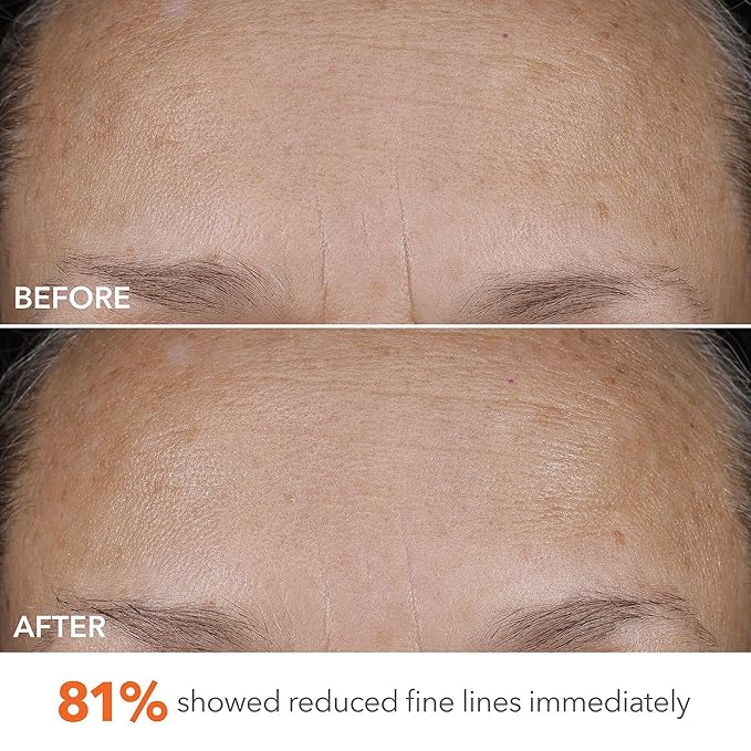 Dr Dennis Gross DermInfusions Blur + Repair Cream, Instantly Blurs Fine Lines, Smooths Skin with Satin-Matte Finish, Visibly Plumps & Firms, Reduces Redness, and Improves Skin Elasticity, 1.7 Fl Oz